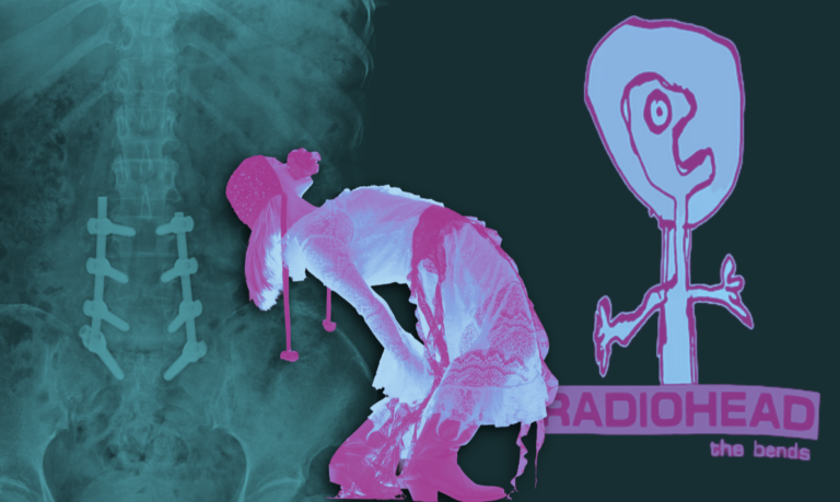 Thirty-One years of decompression sickness: A review of Radiohead’s “The Bends”